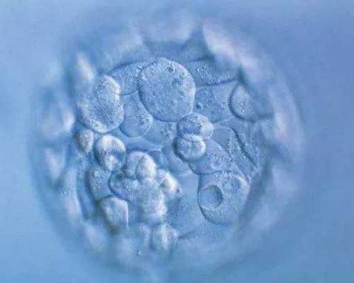 香港验血测性别准吗,香港验血性别报告单准不准,几个y才是男的该如何预约