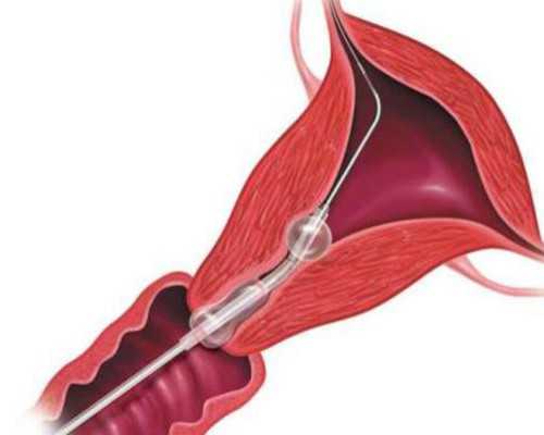 香港验血预约平台,备孕喝纯牛奶好吗