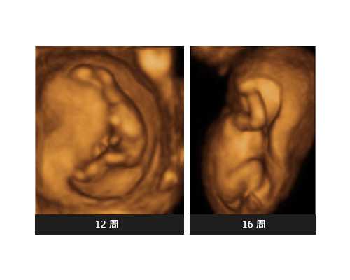 分享怀孕6周香港验血经历给宝妈_香港哪个医院可以鉴定胎儿性别_那些你所不知