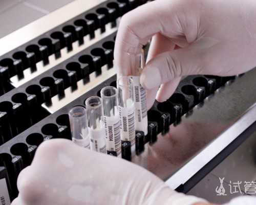 全香港最便宜验血价格,重庆哪里的不孕不育的医院好