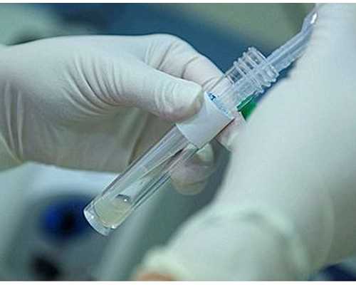 香港验血血抽早了能准吗,试管婴儿降调多久开始促排