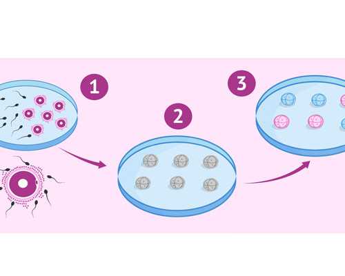 香港验血哪个诊所比较靠谱,男女备孕前需要测染色体吗