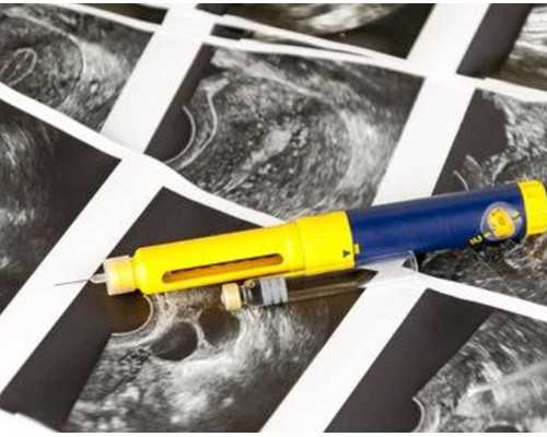 古玩鉴定十大专家,八字测命正宗方法八字命最好