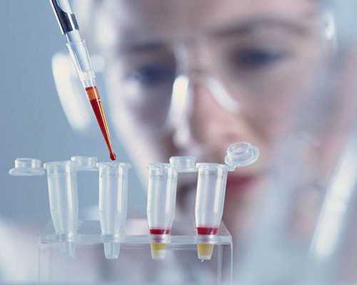 稽留流产半年后怀孕 能香港验血吗,男子备孕前检查有哪些项目