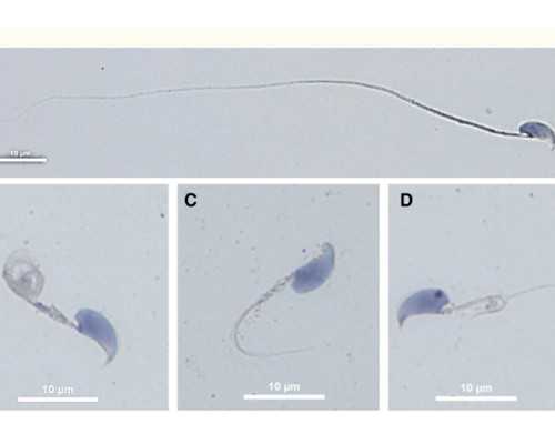有谁知道香港验血准不准,香港医院可以验血测男女吗_查男女哪家最权威