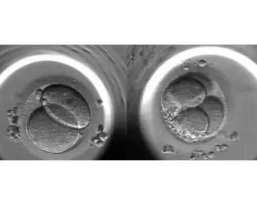 香港dna验血的费用,香港安盛诊所验血准吗_验血查男女哪家最权威