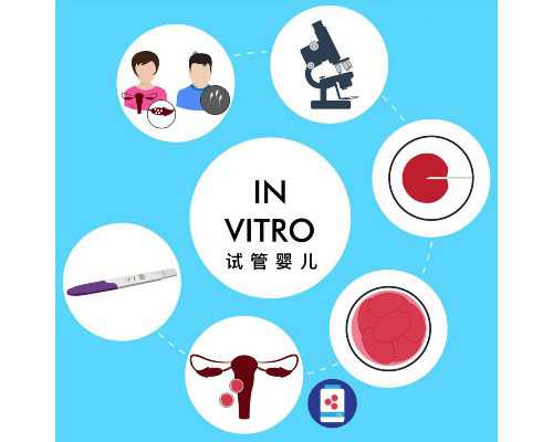 广东上门收购古玩古董,屁股大骨盆会大吗