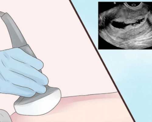 廊坊天香港验血直通车_关于战争与和平的作文400字左右战争与和平 的作文600字