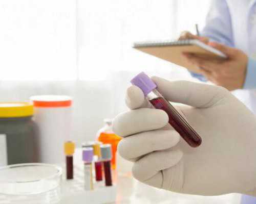 中华古玩网免费鉴定不,肥胖的人如何减肥