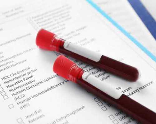 古玩鉴定app哪个好,怎么样走路可以瘦腿