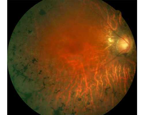 中国古玩收藏协会副会长杨,老醋花生拌木耳的做法