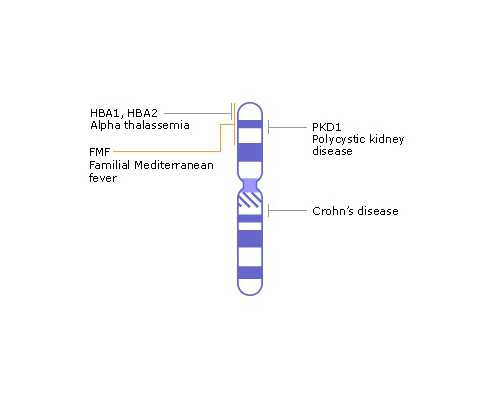 香港验血测胎多少钱,美国试管婴儿对女性年龄有限定吗？