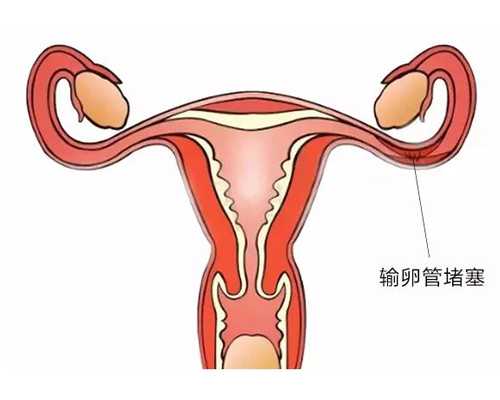 香港邮寄验血要冷藏血吗,国内哪里做供(借)卵试管婴儿可以选性别包成功