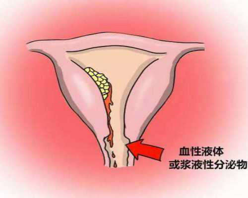 香港早孕验血的原理,验孕棒与验孕试纸哪个比较准确呢？备孕期间怎样选择好
