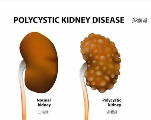 香港验血邮寄血样流程,备孕期间女性可以吃辣的吗？吃了麻辣烫有没有关系？