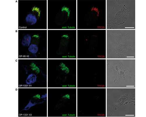 成都正规古董古玩交易,黑咖啡有减肥功效吗?