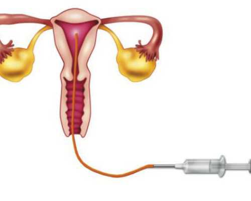 香港验血邮寄预约,为什么要提前三个月备孕？除了补叶酸，这几点也是优生优
