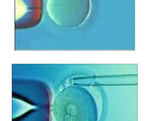 怀孕一个月验血搜香港卓信,香港那4家化验血查男女公司_鉴定性别需要什么条件