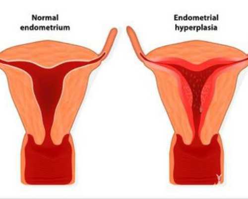 香港做验血多少钱,不孕不育症高发，民盟中央建议将辅助生育费用纳入生育保