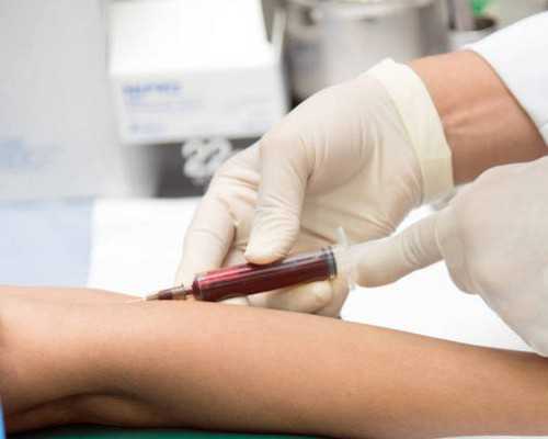 香港验血机构达雅高,香港验血18个-ve是男孩还是女孩,抽血鉴定性别要多少费用