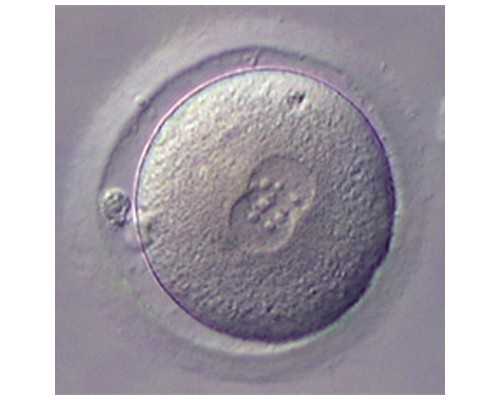 邮寄香港验血为什么都是女孩,来月经第一天同房了怎么办 经期同房后一定要这