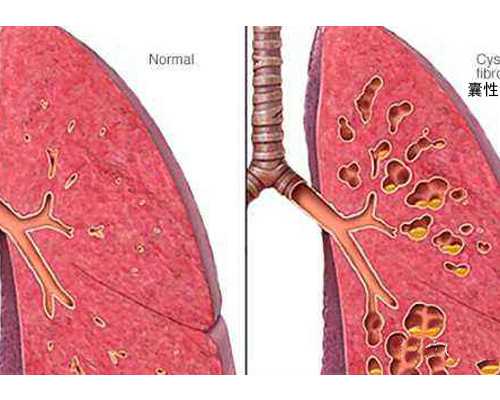 古玩虫罗爷,为什么说白羊男怕碰到巨蟹女白羊男巨蟹女在一起很累
