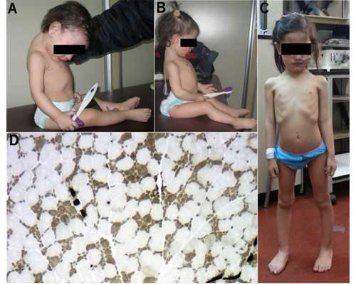 喀什古董古玩鉴定地址,动脉粥样硬化中医治疗