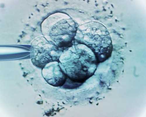 11周香港验血准吗,做试管前注意事项有哪些？