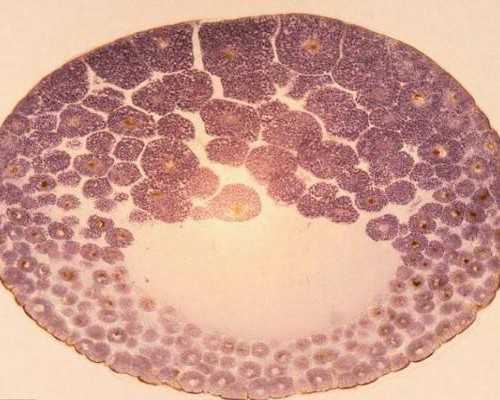 香港验血查性别最晚怀孕几周,女性输卵管结扎了可以做海外试管婴儿吗?