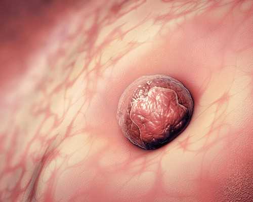 香港验血查性别靠谱么,直击做试管婴儿全过程，场面太震撼，看着心疼女人一