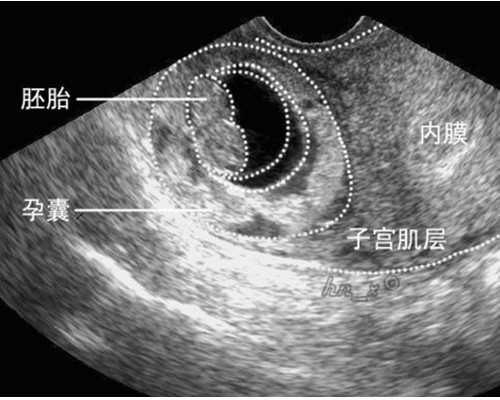 网上古玩交易平台哪个好,做胎儿亲子鉴定费用大概要多少