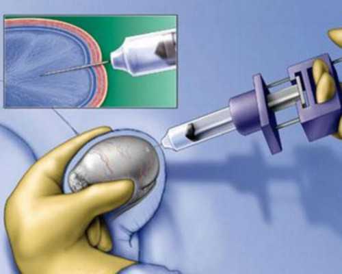 香港验血20多周准确么,别担心了，做过结扎手术还可以赴泰国试管婴儿