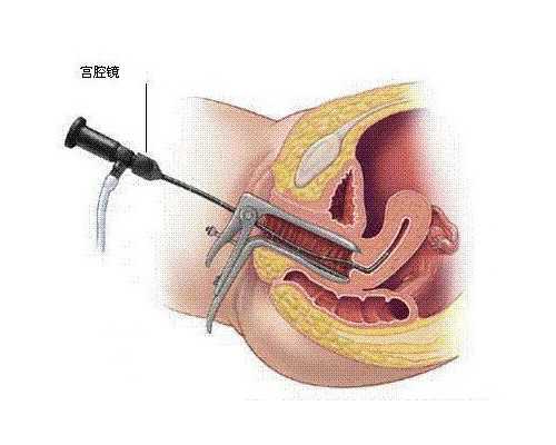 香港验血陈立志电话,人工助孕能花多少钱？附全流程费用明细？