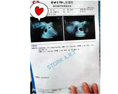 怀孕五个月还能香港验血吗,去香港能查男女吗_验血没y生了男孩还是女孩