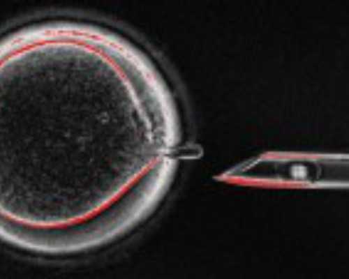 香港验血7周胎芽8mm,北大龙凤胎国际试管婴儿-孕妇地中海贫血检查时间