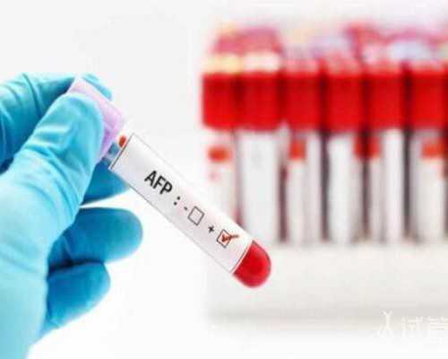 弘钰博古玩收藏,八字带什么说明有阴德天之命