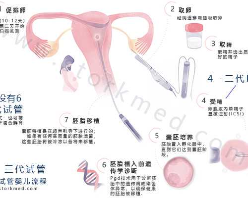 香港验血做出来是女孩,美国试管婴儿进入周期后的注意事项有哪些