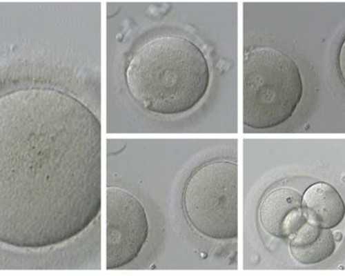 广州古玩诈骗公司高管,白癜风的中医治疗