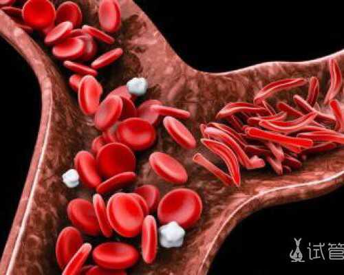 古玩虫儿罗爷,子宫腺肌症合并子宫肌瘤能怀孕吗