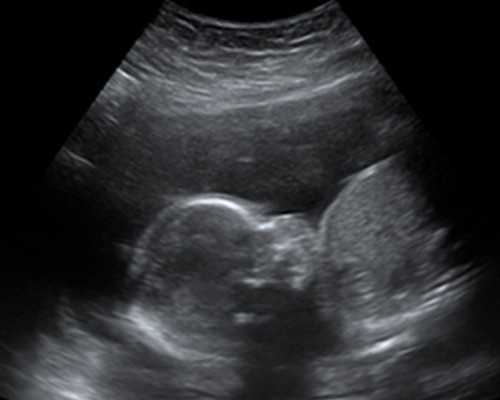 民国古玩电视剧大全,治疗颈椎的药酒