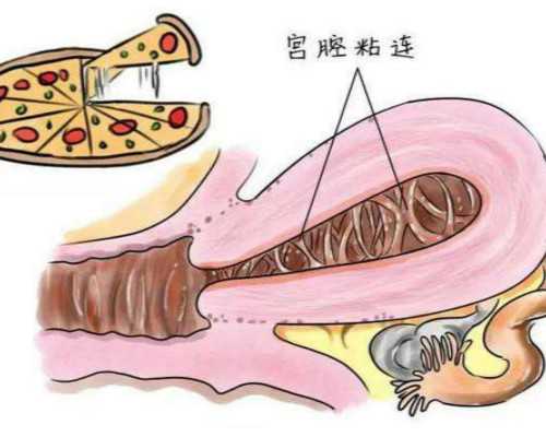 合肥试管最佳服务机构哪家好_合肥试管婴儿哪家好！