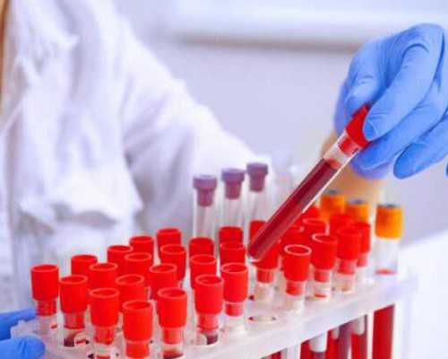 古玩古董鉴定,泰式酸辣虾球