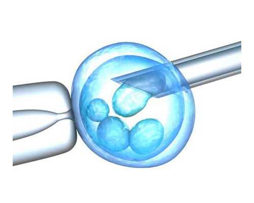 香港验血鉴别男女费用,备孕二胎被发现无精子症，难道大娃是“隔壁老王”家