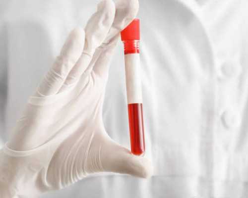 香港验血都知道是男是女,试管婴儿老司机备孕多年，焦虑自闭强迫症如何自我