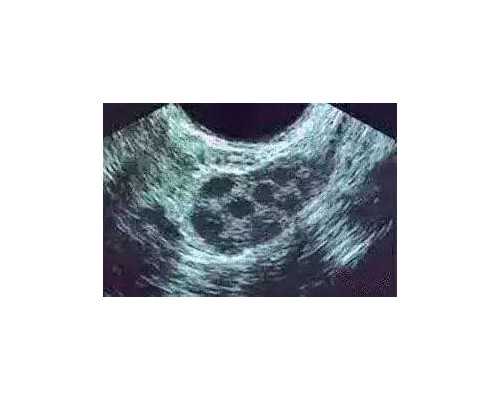 香港6周验血测胎儿性别最新消息,男性备孕泰国试管婴儿要做哪些准备？