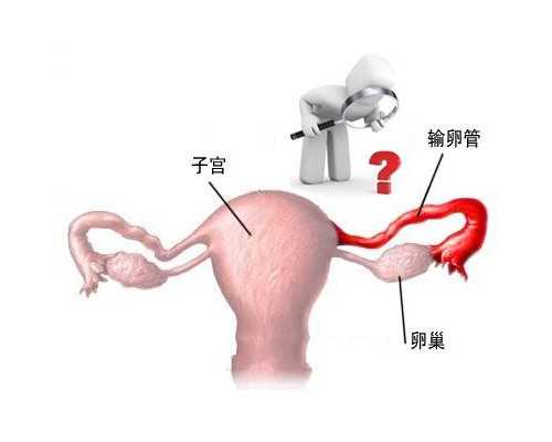 古玩包装盒定制,前列腺结节需要手术吗