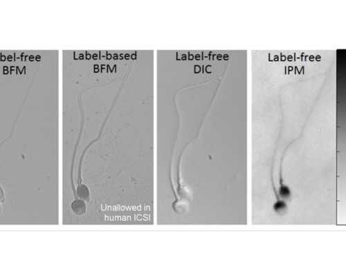 古玩类小说排行榜前十名,叉子吃饭减肥法变瘦很简单