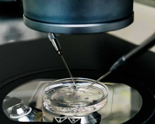 古玩大亨全文免费阅读生蚝视频aqq,艾灸减肥会反弹吗