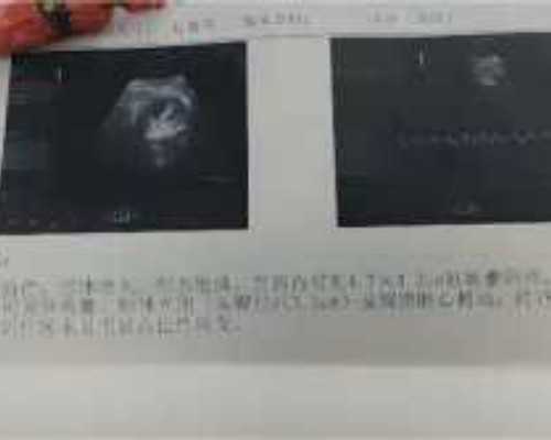 直接去香港验血要多少钱,以劳动节为主题的作文600字。5.1劳动节   作文500字