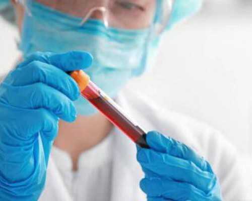 我要验血带去香港查男女,泰国三代试管前期检查项目有哪些?